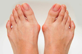 Fat Pad Atrophy treatment