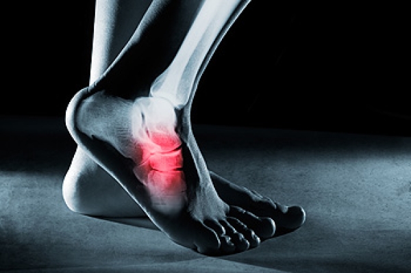Tendonitis Pain In The Heel And Side Of Foot Heel Hurts While